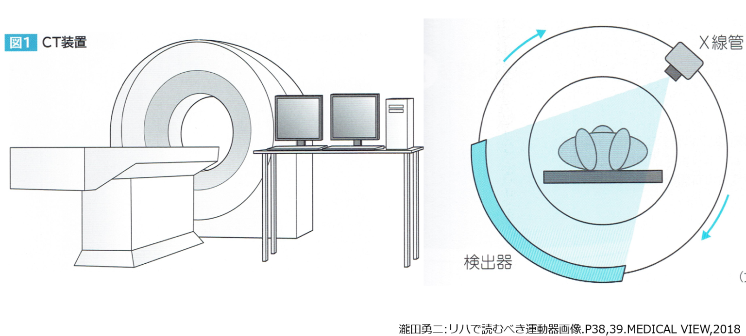 画像読影の基礎②～CT画像～ | はるのリハビリ室